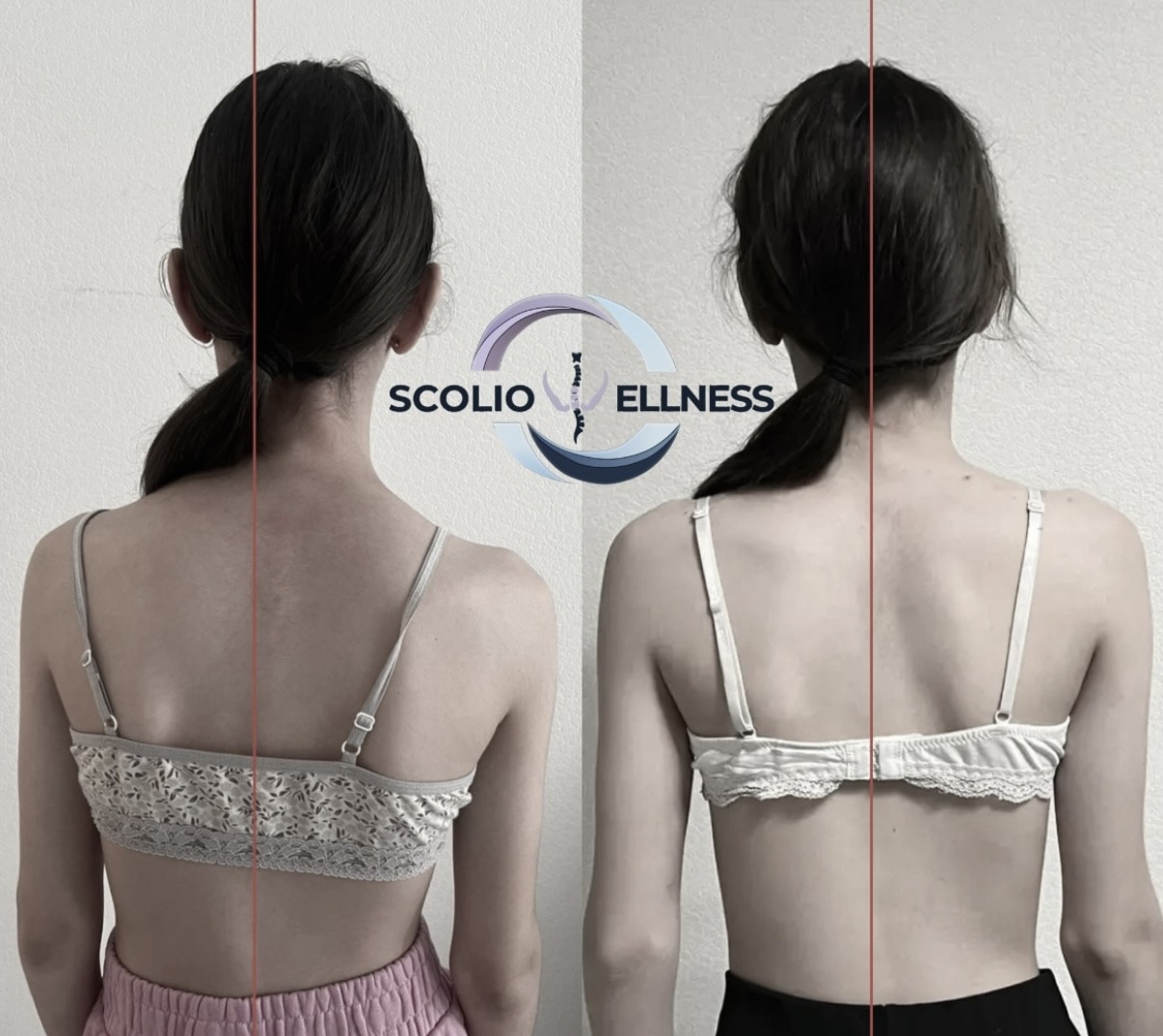 Пример из практики школы SCOLIO WELLNESS — 2