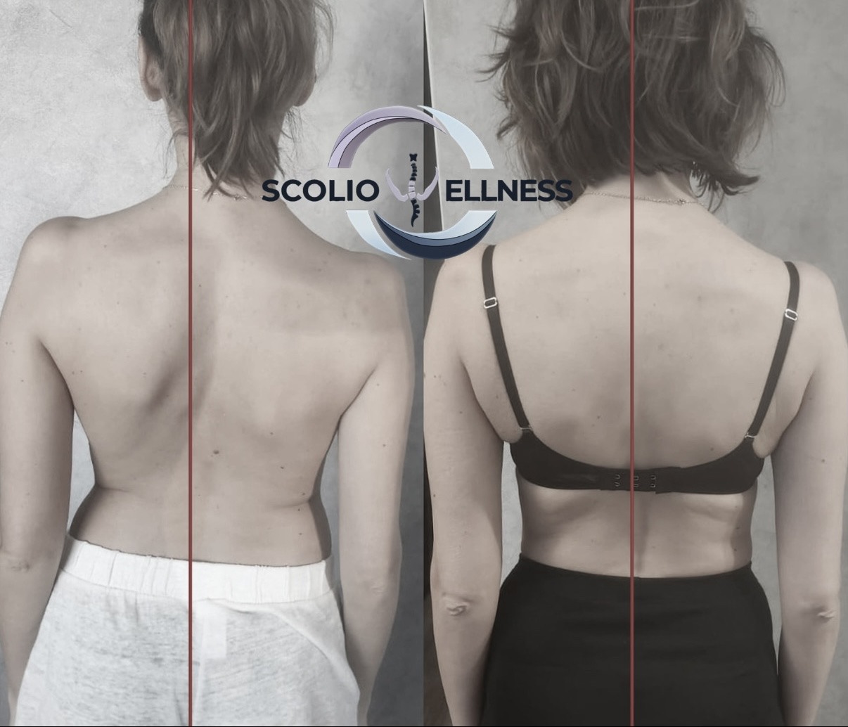 Пример из практики школы SCOLIO WELLNESS — 5