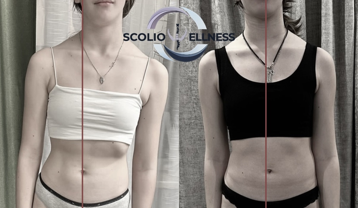 Пример из практики школы SCOLIO WELLNESS — 4